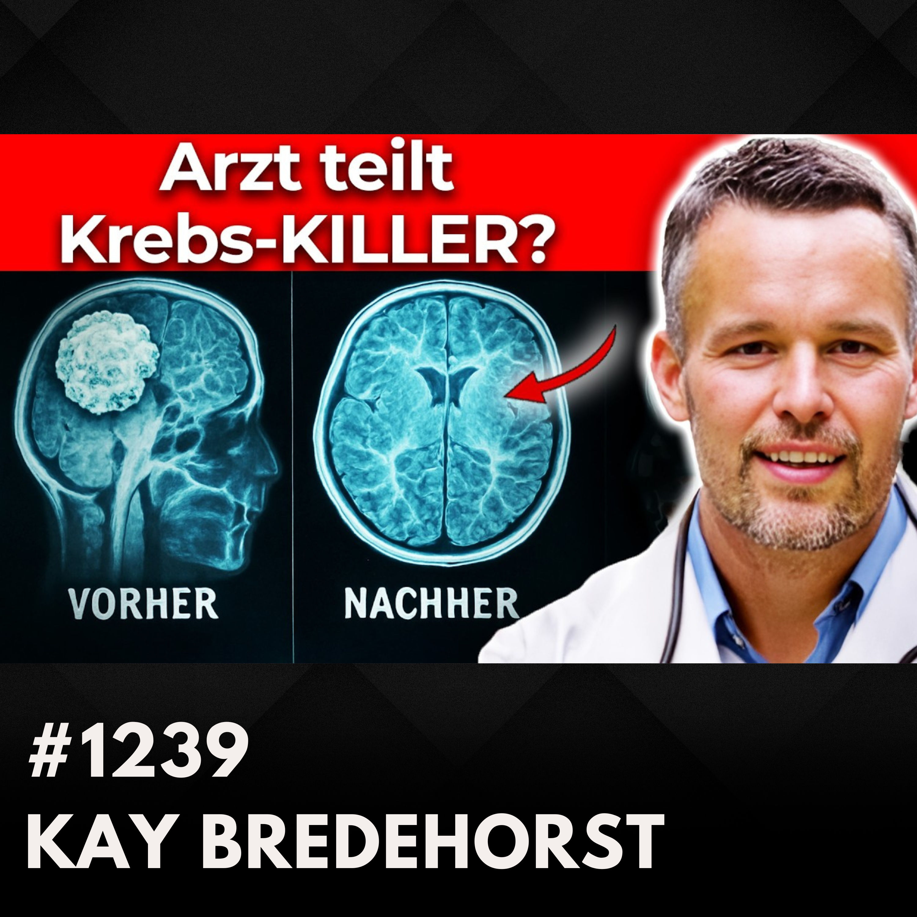 Turbokrebs Wahnsinn: DAS könnte Krebszellen zerstören? | Dr. Kay Bredehorst #1239