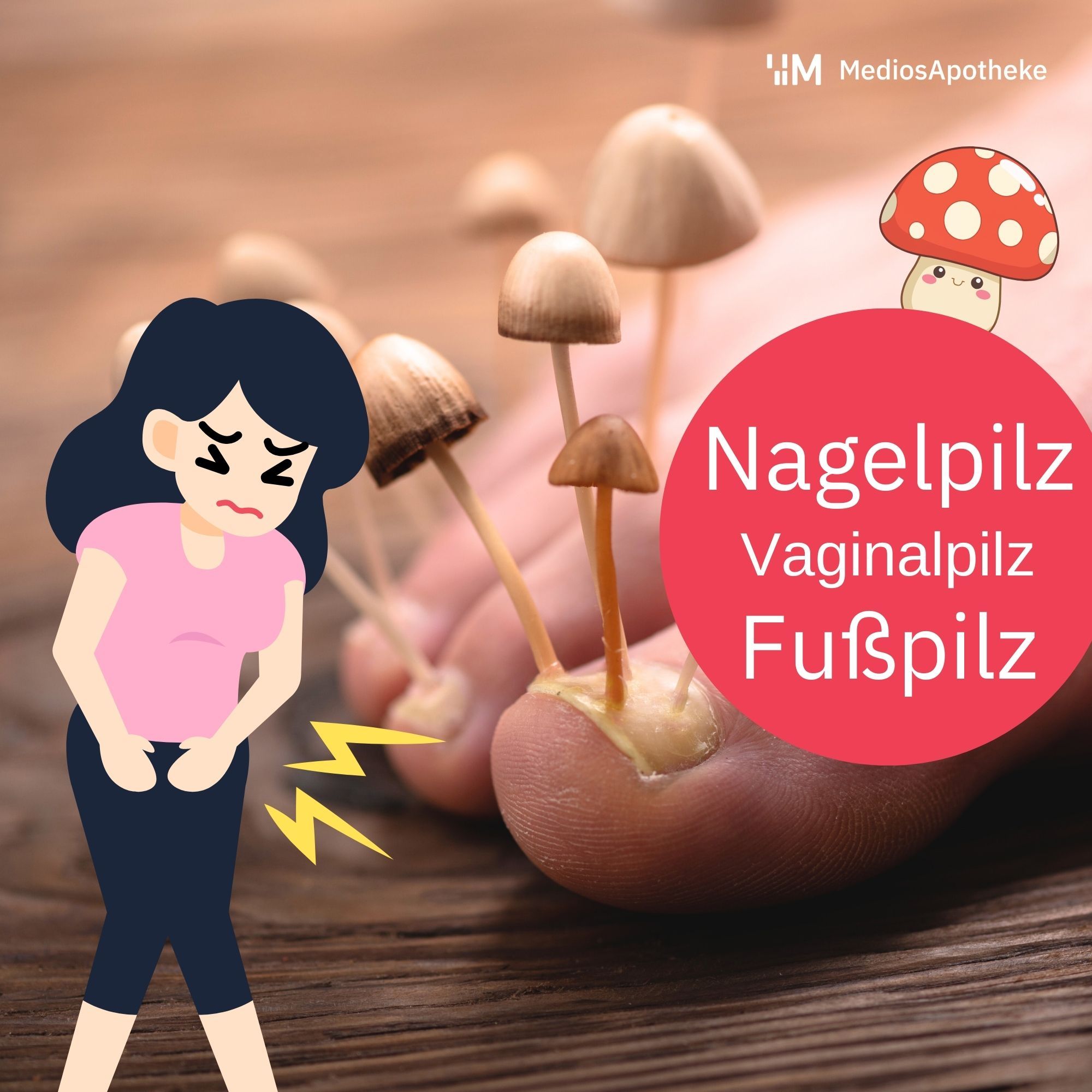 Vaginalpilz, Fußpilz, Nagelpilz findet man nicht im Wald - Symptome und Behandlung von Hautmykosen