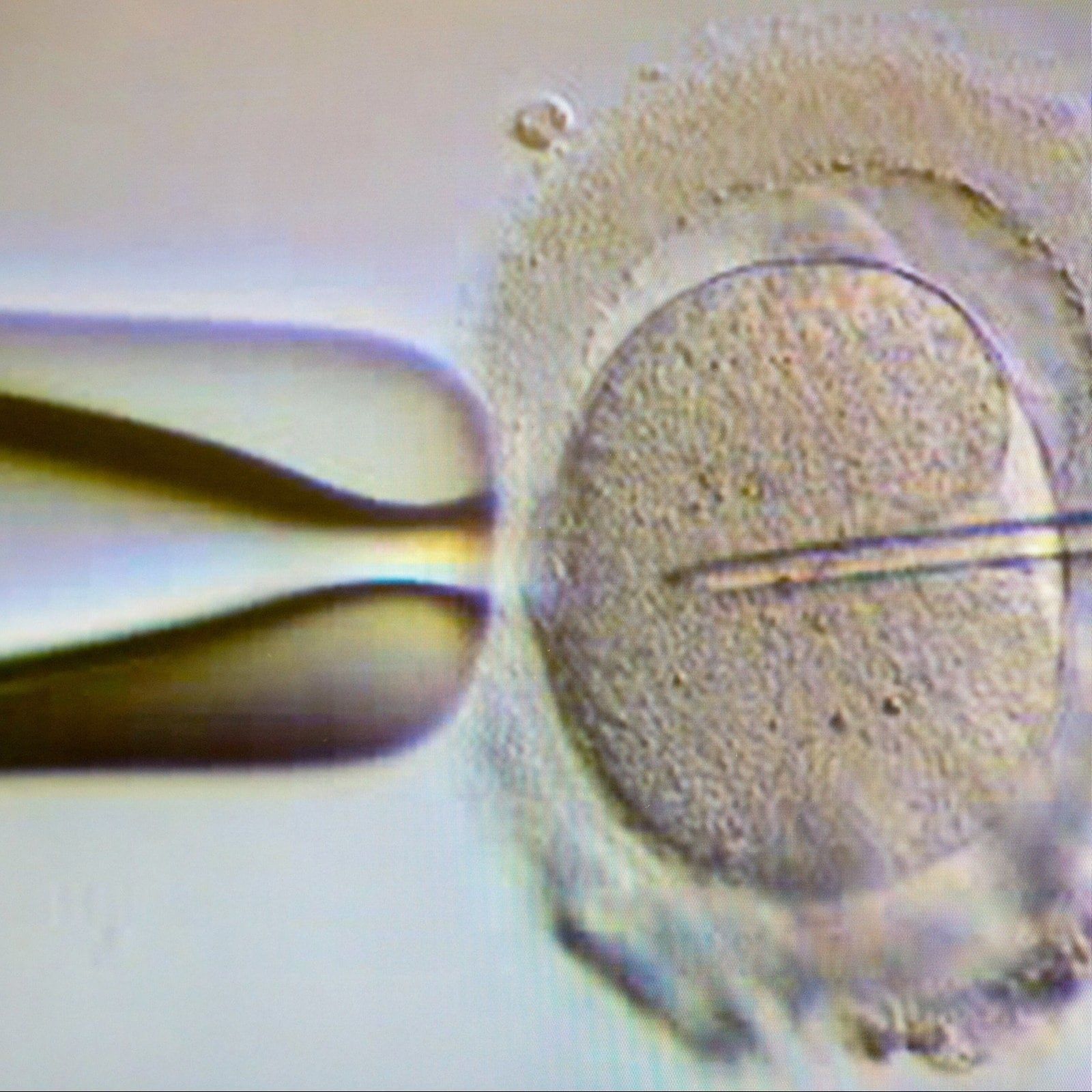 Warken will Eizellspende teilweise legalisieren