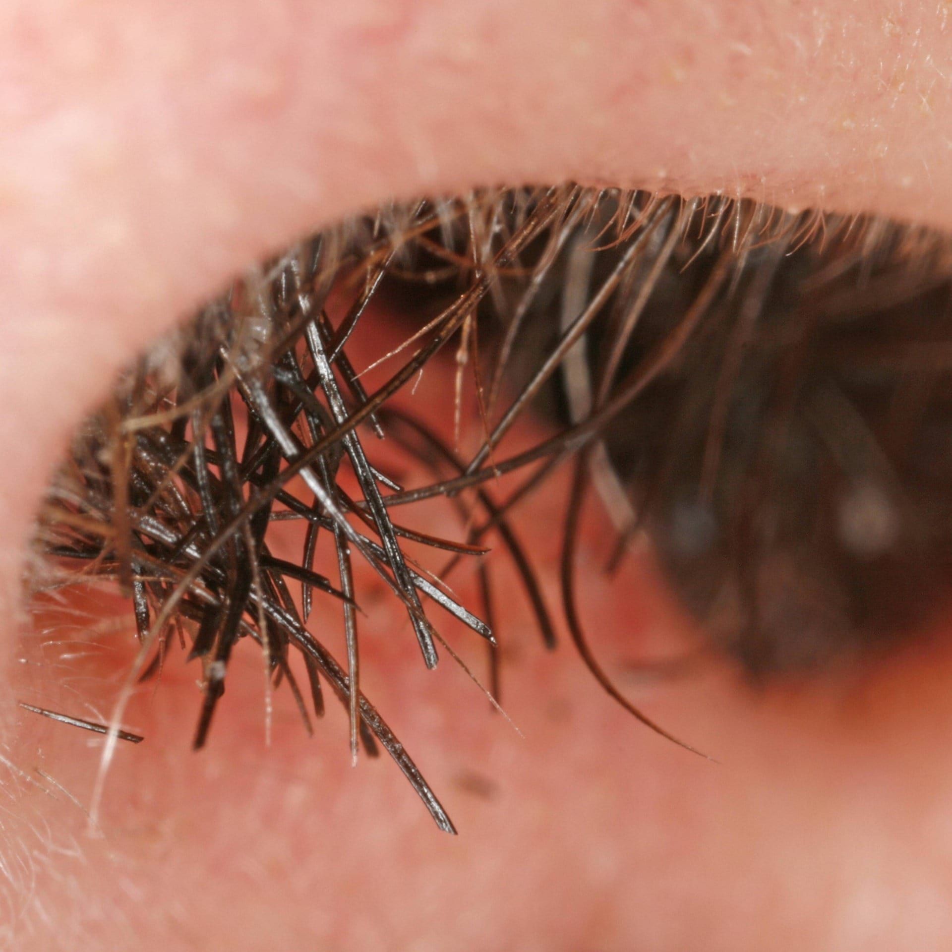 Warum wachsen im Alter Haare in Ohr und Nase, während sie auf dem Kopf eher ausfallen?