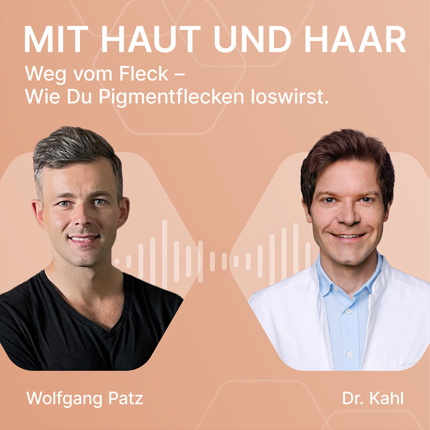 Weg vom Fleck – Wie Du Pigmentflecken loswirst.