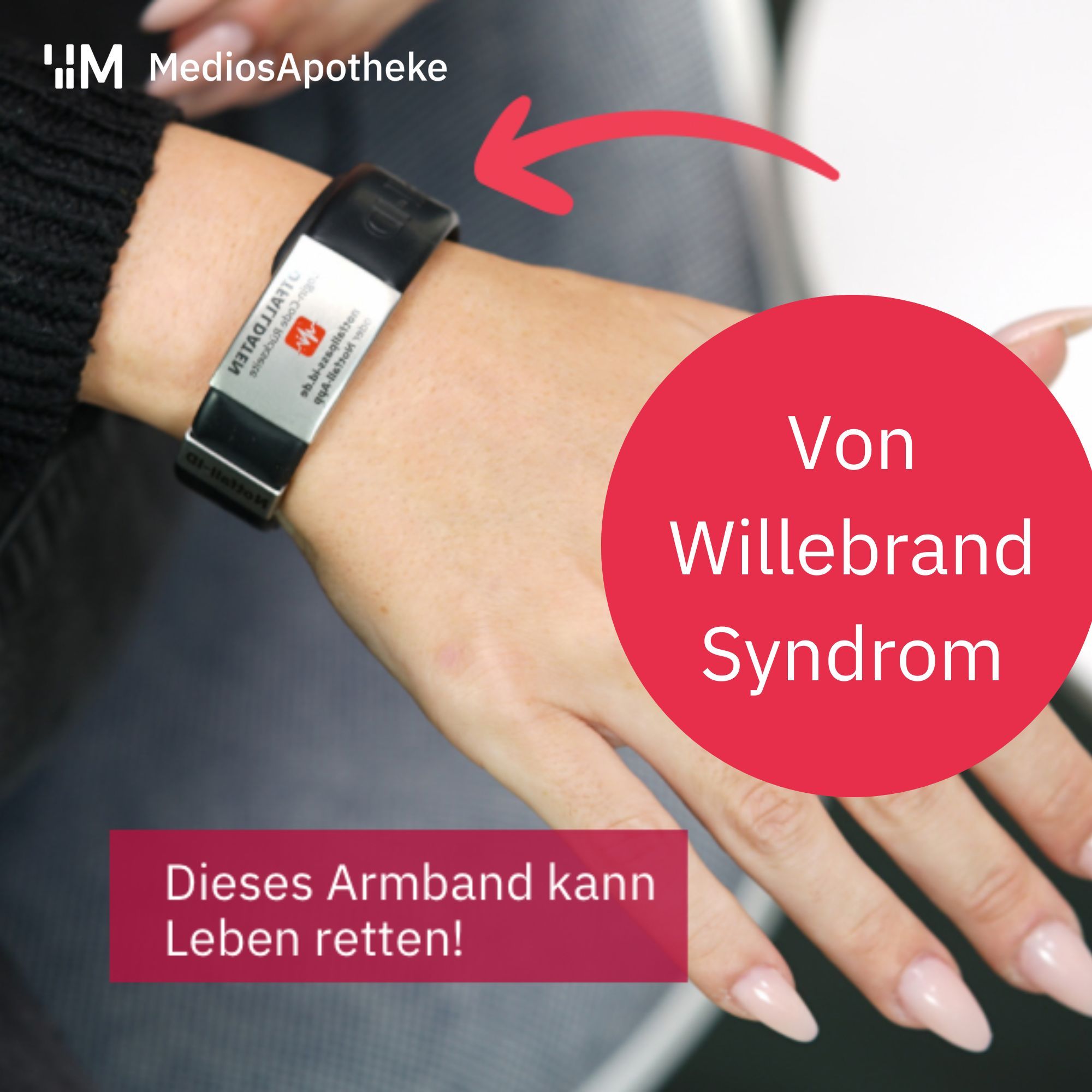Wenn es nicht nur blaue Flecken sind - Das von-Willebrand-Syndrom und der vWS Faktor
