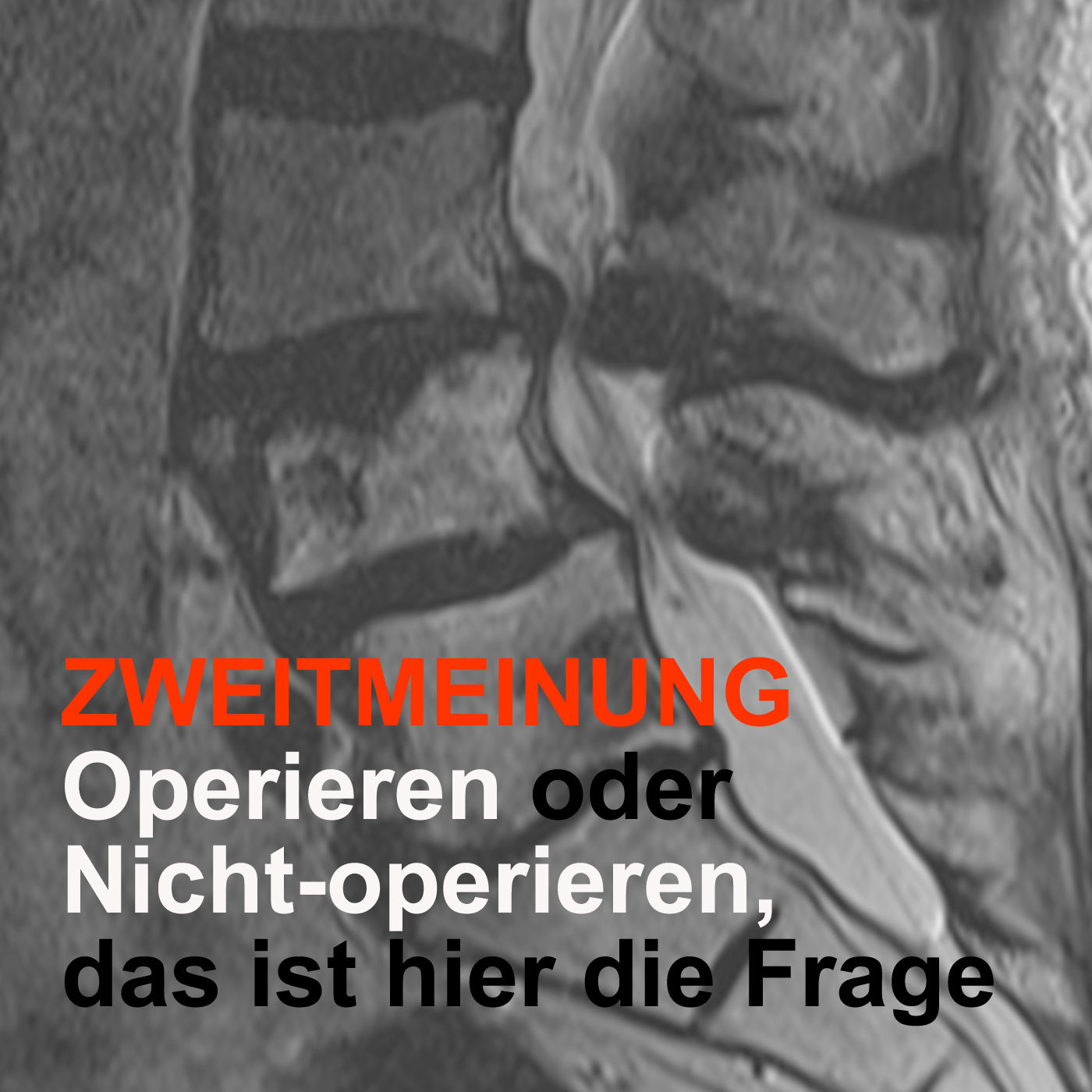 ZWEITMEINUNG - Operieren oder Nicht-operieren, das ist hier die Frage